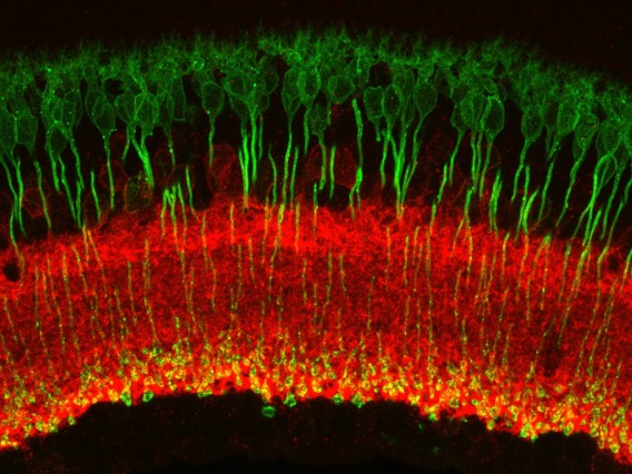 An image of a retina captured under a microscope by Andrea Wellington, assistant research scientist in the Eggers Lab in the Department of Physiology at the College of Medicine – Tucson, shows rod bipolar cells labeled in green and inhibitory amacrine cells (GABAergic) labeled in red.