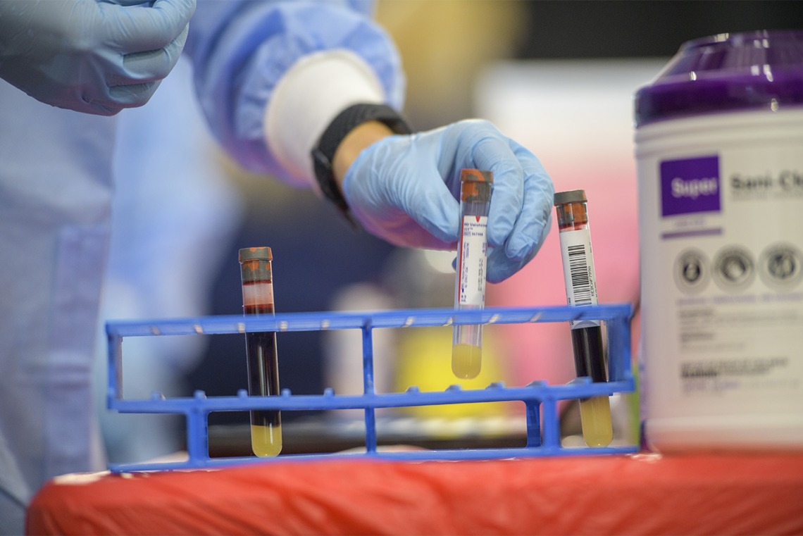 Blood samples are gathered from the first phase of testing in a partnership between the University of Arizona and the state.