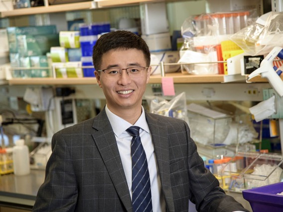 Fei Yin, PhD, will use a new NIH grant to continue his study of the Alzheimer’s risk gene ApoE4 and its effect on lipid homeostasis in the brain. 