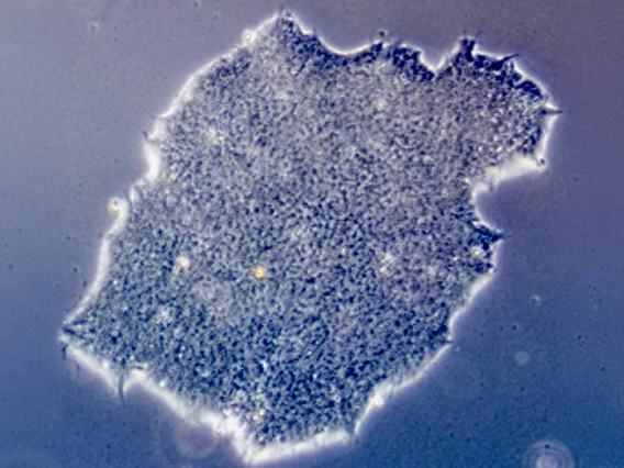 A colony of stem cells in culture