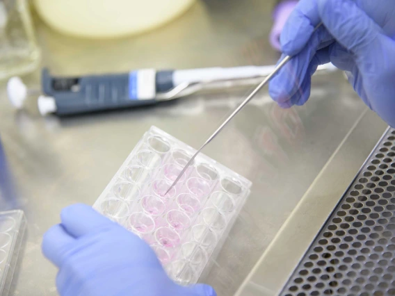  A close-up, high-angle shot of a person in a lab setting, wearing blue latex gloves. The person is using a long, thin metal tool to transfer a substance to a clear plastic plate with multiple wells, some of which contain a pink liquid. In the background, a pipette and other lab equipment are visible on a stainless steel surface.