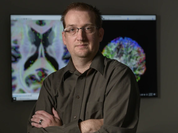 By mapping out the nerve fibers that traverse the brain, Dr. Adam Raikes illuminates this normally unseen part of the anatomy for scientists devoted to treating neurodegenerative diseases.