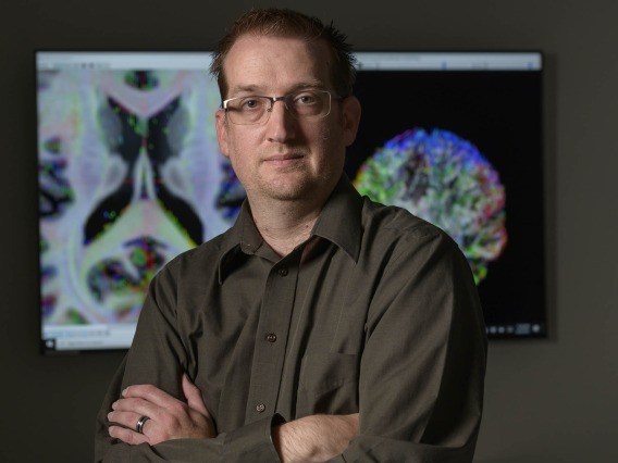 By mapping out the nerve fibers that traverse the brain, Dr. Adam Raikes illuminates this normally unseen part of the anatomy for scientists devoted to treating neurodegenerative diseases.