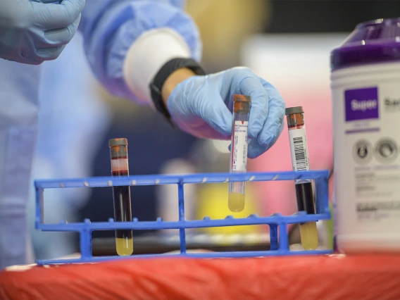 Blood samples are gathered from the first phase of testing in a partnership between the University of Arizona and the state.