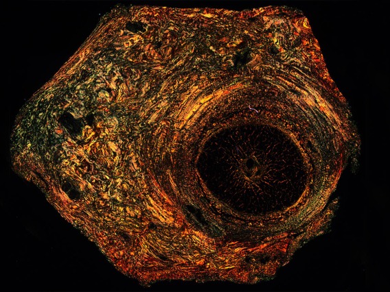 Picrosirius red dye causes collagen to “light up” under polarized light in this image of a retina, the light-sensitive part of the eye. The sectioning and staining were performed by the late Andrea Grantham. Image submitted by Douglas Cromey, MS, associate scientific investigator in the College of Medicine – Tucson.