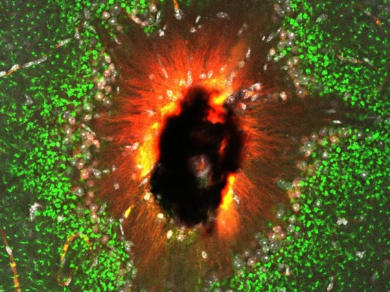 To investigate the effects of diabetes on vision, researchers in the Eggers Lab peek at retinas under high-powered microscopes. Andrea Wellington, assistant research scientist in the Department of Physiology at the College of Medicine – Tucson, captured the back of the retina in this image, titled “The Eye of Sauron.”