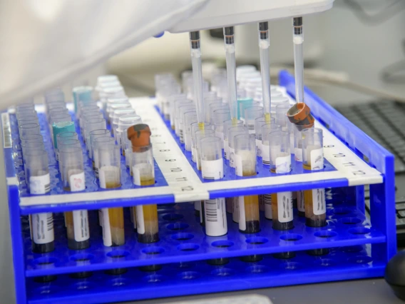 Barbara Fransway, manager of University of Arizona Genetics Core Research Services, transfers blood serum into testing plates to determine if the samples contain antibodies to the virus that causes COVID-19.
