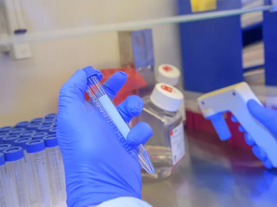 Michael Badowski, PhD, holds a test tube with a media in it for preserving COVID19 sample cells.