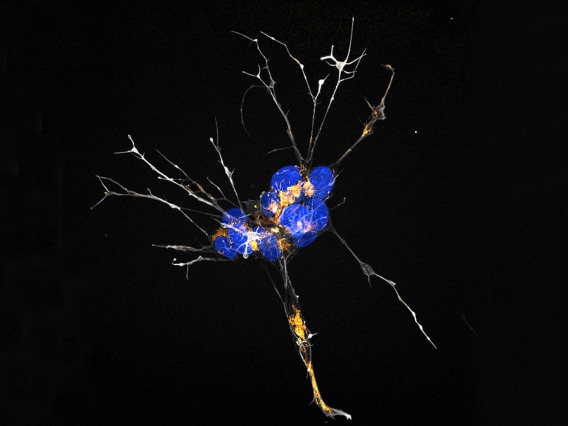 By suppressing estrogen activity in cells, researchers explore how decreased estrogen affects the brain during menopause. Actin, the cell’s “skeleton,” is shown in white and the nuclei are shown in blue. The mitochondria, which power the cells, are dyed orange.  Image submitted by Marco Padilla-Rodriguez, PhD, microscopy specialist in the Brinton Lab at the Center for Innovation in Brain Science.