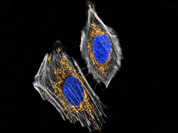 To investigate a hypothesis that decreased estrogen influences the brain during menopause, researchers use microscopes to visualize changes in a cell’s mitochondria (dyed orange) when estrogen activity is suppressed.  Image submitted by Marco Padilla-Rodriguez, PhD, microscopy specialist in the Brinton Lab at the Center for Innovation in Brain Science.