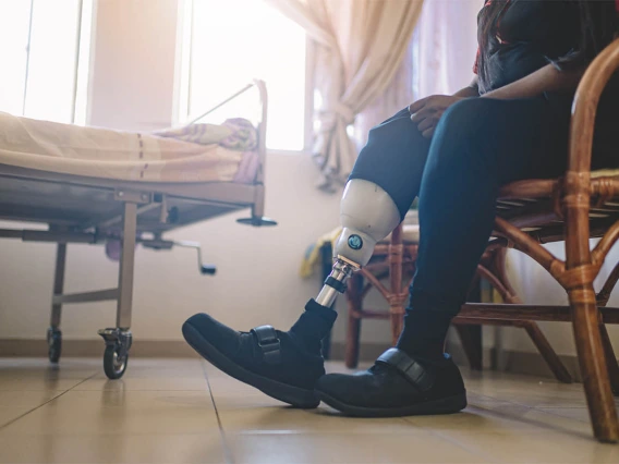 Expanded access to insurance coverage was accompanied by an improvement in limb salvage care, according to the results of a study led by University of Arizona Health Sciences researchers.