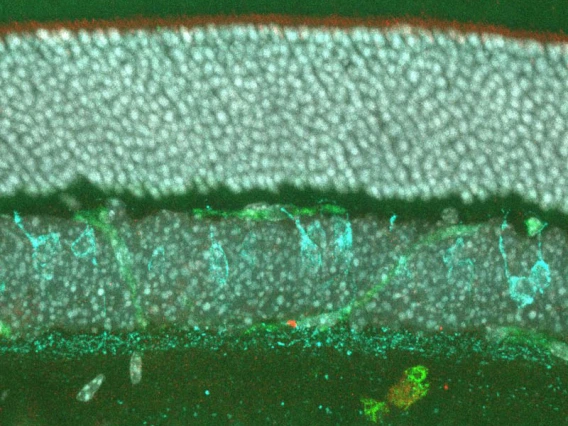 Image taken under a microscope shows the inner retina with cone bipolar cells genetically labeled in cyan, photoreceptors and blood vessels labeled in green and cell nuclei labeled in white. The shape of a little smiling fish appears toward the bottom.