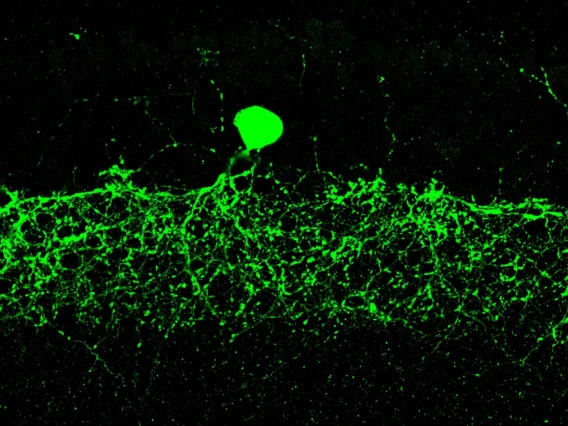 This image, captured under a confocal microscope, shows an immunostained dopaminergic amacrine cell in the inner retina.