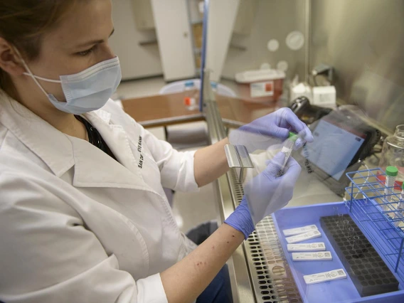 Anete Milkovica, a research technician, opens a test sample. 