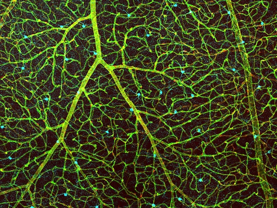 Does this look like an underwater plant or the vasculature of the retina? This image shows the blood vessels in a retina in green, the cells that make up the blood-retina barrier in red, and dopamine-producing amacrine cells in cyan.