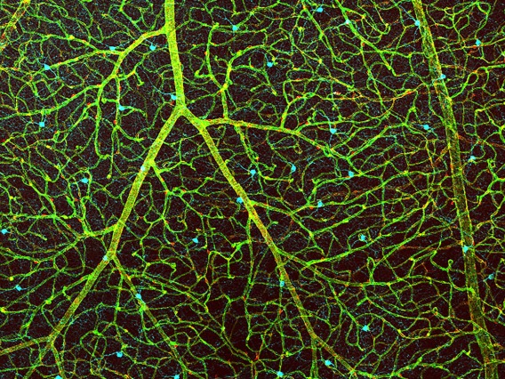 Does this look like an underwater plant or the vasculature of the retina? This image shows the blood vessels in a retina in green, the cells that make up the blood-retina barrier in red, and dopamine-producing amacrine cells in cyan.