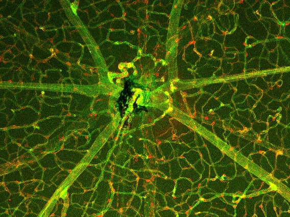 This image was taken with the optic nerve head of a retina in the center. It shows the vasculature of the retina stained green with IsolectinB and the cells that make up the blood-retina barrier stained red with anti-NG2-Cy3.