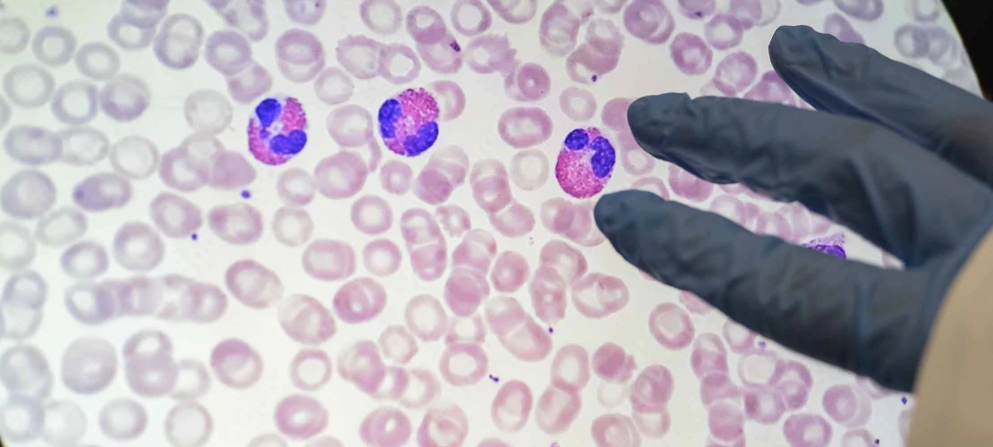 microscope image of cells with a person’s hand pointing at three cells that are brighter in color than the rest.