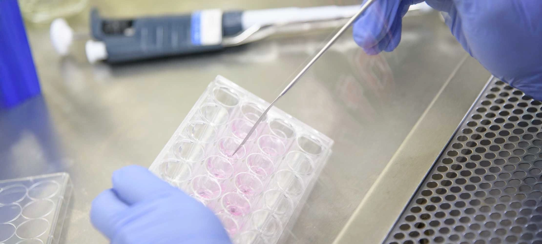  A close-up, high-angle shot of a person in a lab setting, wearing blue latex gloves. The person is using a long, thin metal tool to transfer a substance to a clear plastic plate with multiple wells, some of which contain a pink liquid. In the background, a pipette and other lab equipment are visible on a stainless steel surface.