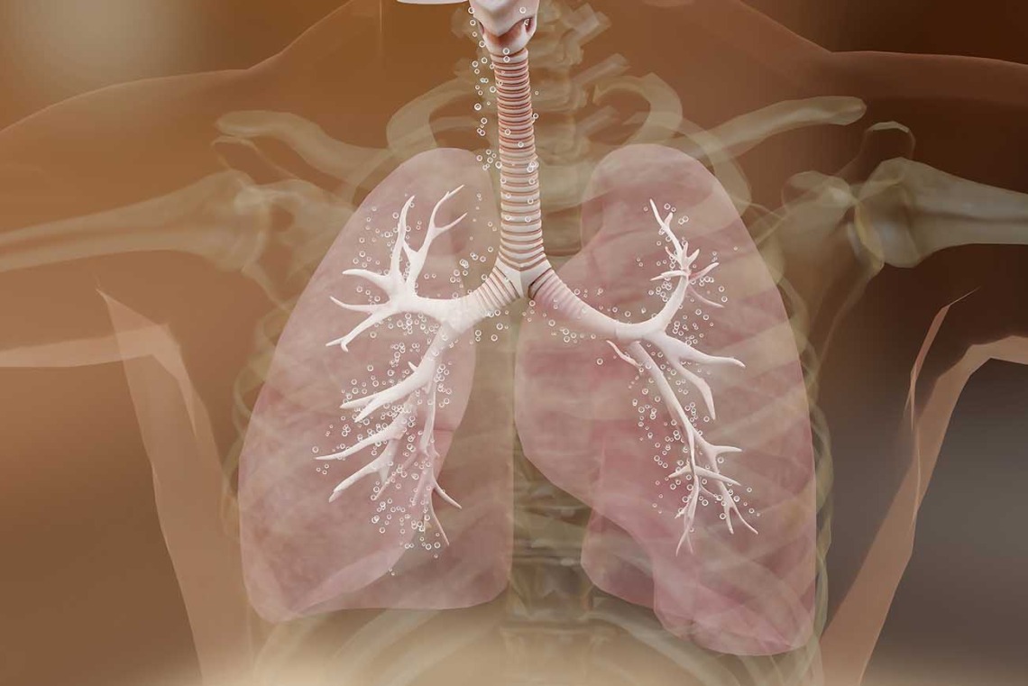 3d Illustration of asthma symptoms in lungs