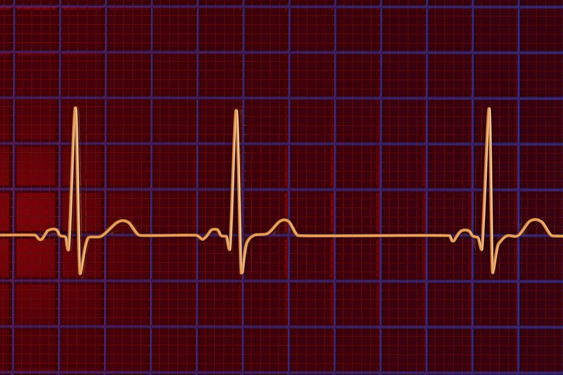 New Therapeutic Target for Cardiac Arrhythmias Emerges