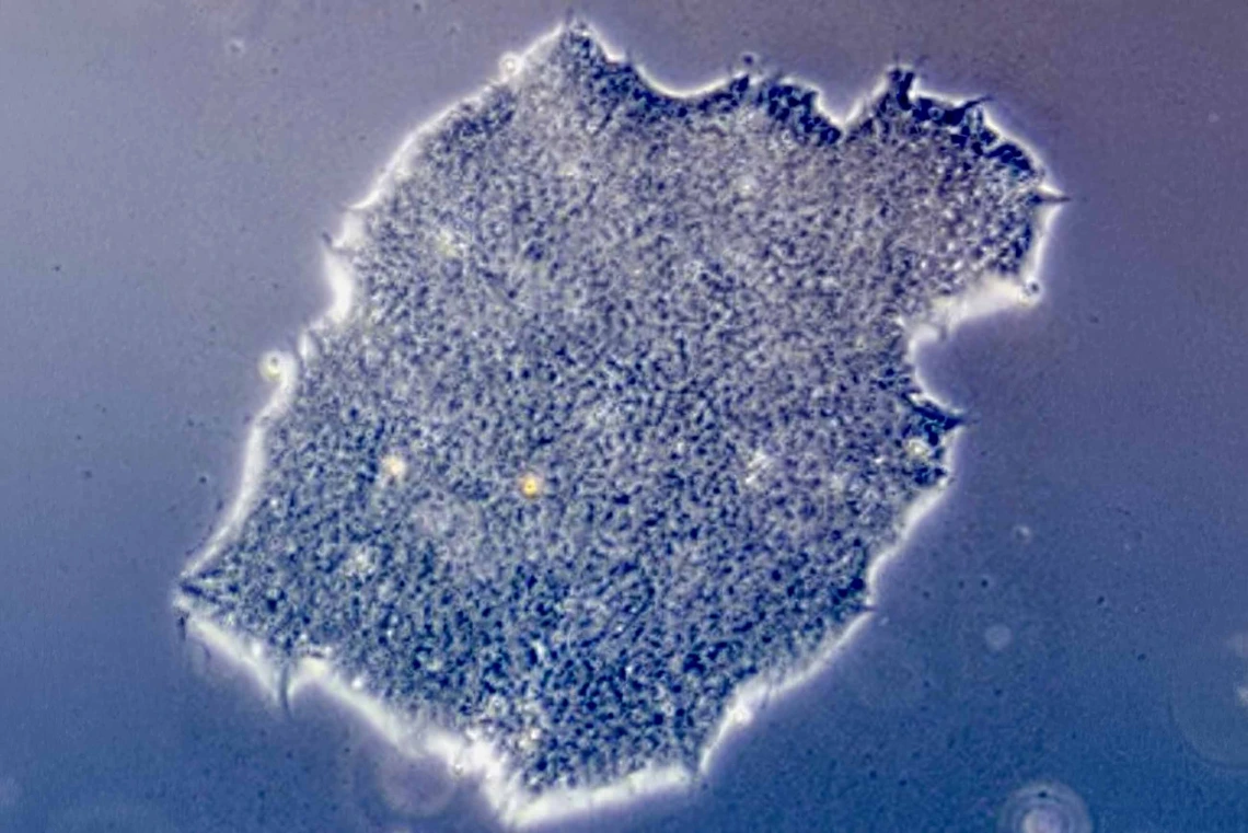 A colony of stem cells in culture