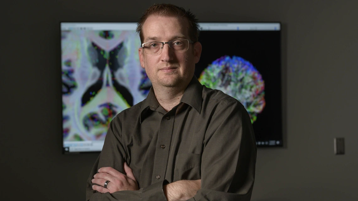 By mapping out the nerve fibers that traverse the brain, Dr. Adam Raikes illuminates this normally unseen part of the anatomy for scientists devoted to treating neurodegenerative diseases.