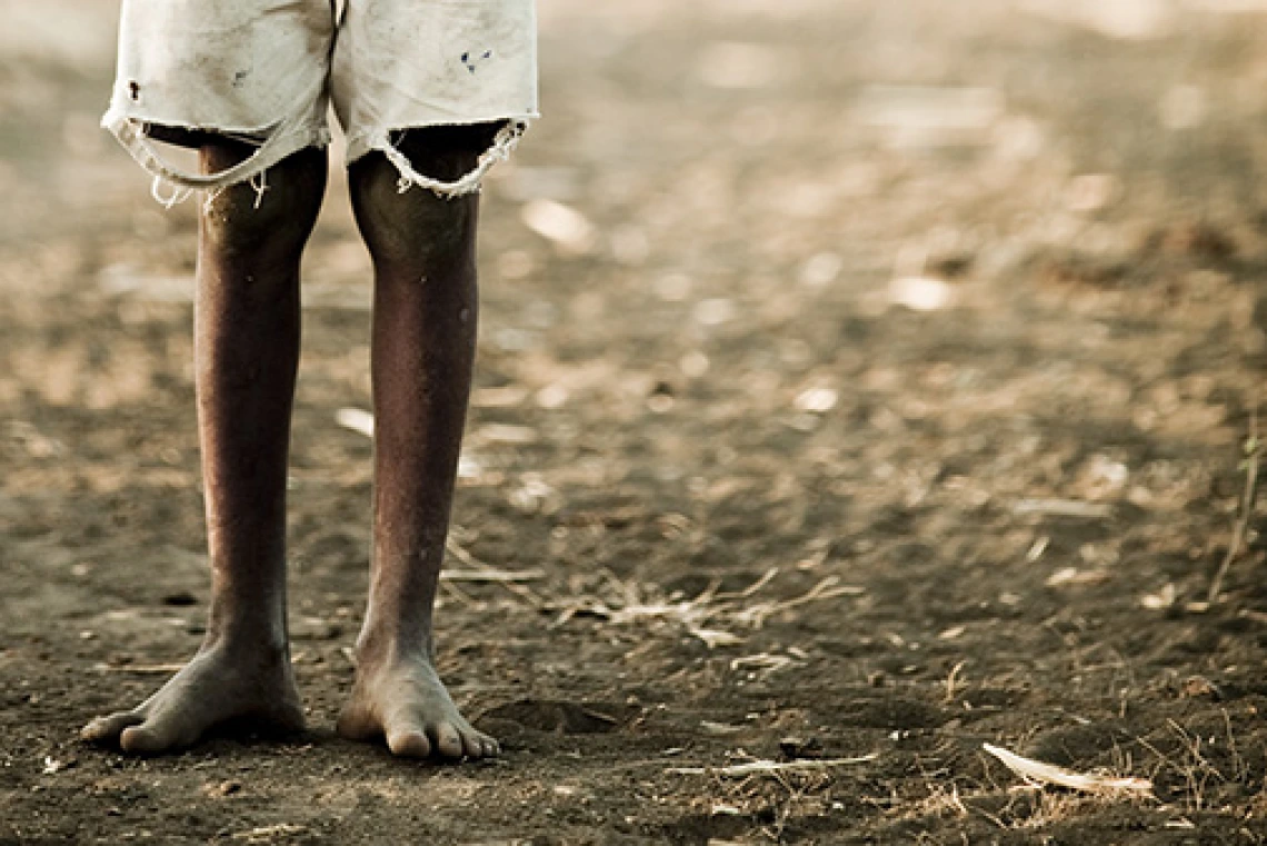 A young boys legs in worn shorts