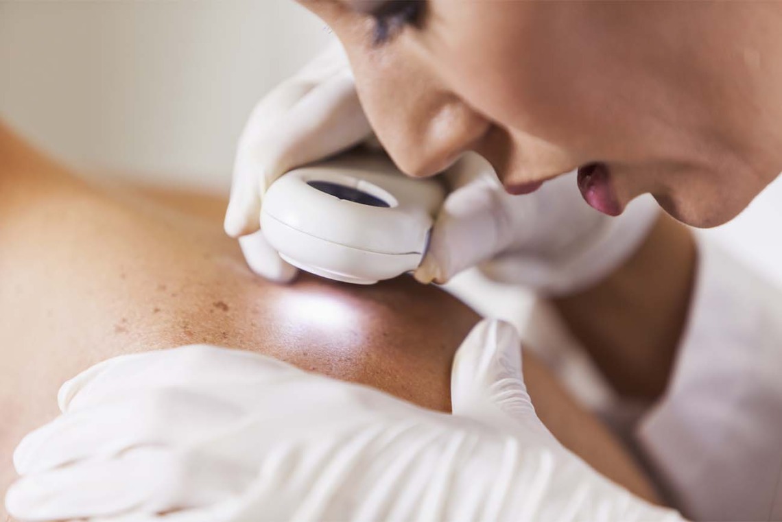 Dermatologist using dermatoscope to examine skin