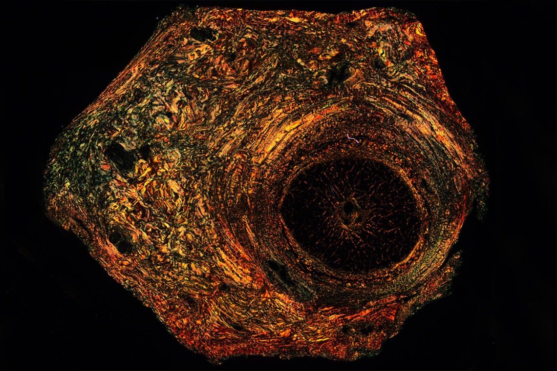 Picrosirius red dye causes collagen to “light up” under polarized light in this image of a retina, the light-sensitive part of the eye. The sectioning and staining were performed by the late Andrea Grantham. Image submitted by Douglas Cromey, MS, associate scientific investigator in the College of Medicine – Tucson.