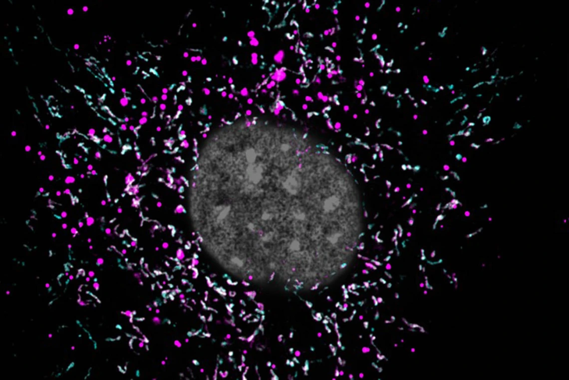 When an astrocyte’s mitochondria (magenta) are impaired, they are unable to break down lipid waste (cyan), and the buildup of extra fat (white spots) might be accelerating the progression of Alzheimer’s disease.