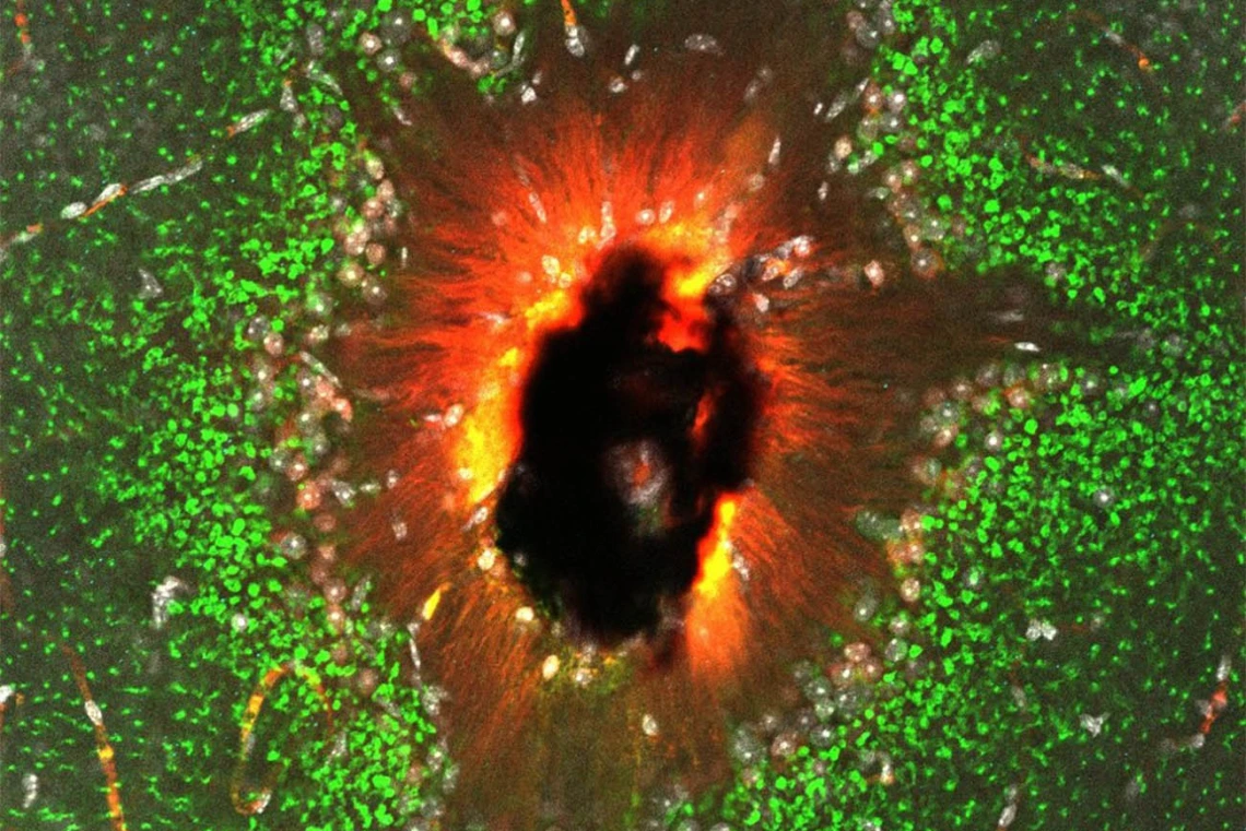 To investigate the effects of diabetes on vision, researchers in the Eggers Lab peek at retinas under high-powered microscopes. Andrea Wellington, assistant research scientist in the Department of Physiology at the College of Medicine – Tucson, captured the back of the retina in this image, titled “The Eye of Sauron.”