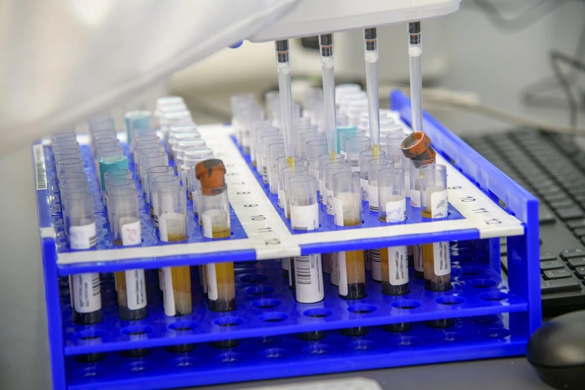 Barbara Fransway, manager of University of Arizona Genetics Core Research Services, transfers blood serum into testing plates.