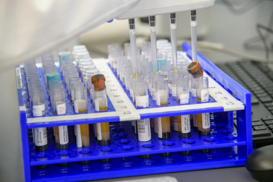 Barbara Fransway, manager of University of Arizona Genetics Core Research Services, transfers blood serum into testing plates to determine if the samples contain antibodies to the virus that causes COVID-19.