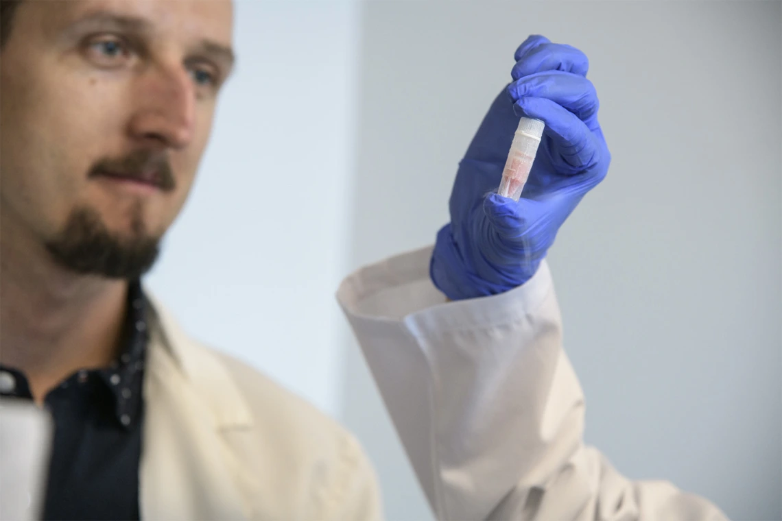 Paweł Łaniewski, PhD, selects cells preserved through cryopreservation. These cells might help establish a link between the vaginal microbiome and susceptibility to gynecologic cancers.