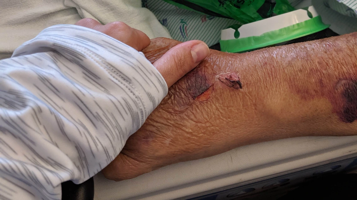 Tara Sklar, professor of health law and director of the Health, Law and Policy program at the University of Arizona James E. Rogers College of Law, holds her father’s hand for the last time while he was in hospice. (photo courtesy of Tara Sklar)