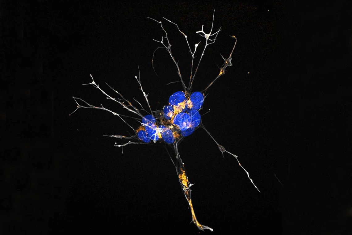 By suppressing estrogen activity in cells, researchers explore how decreased estrogen affects the brain during menopause. Actin, the cell’s “skeleton,” is shown in white and the nuclei are shown in blue. The mitochondria, which power the cells, are dyed orange.  Image submitted by Marco Padilla-Rodriguez, PhD, microscopy specialist in the Brinton Lab at the Center for Innovation in Brain Science.