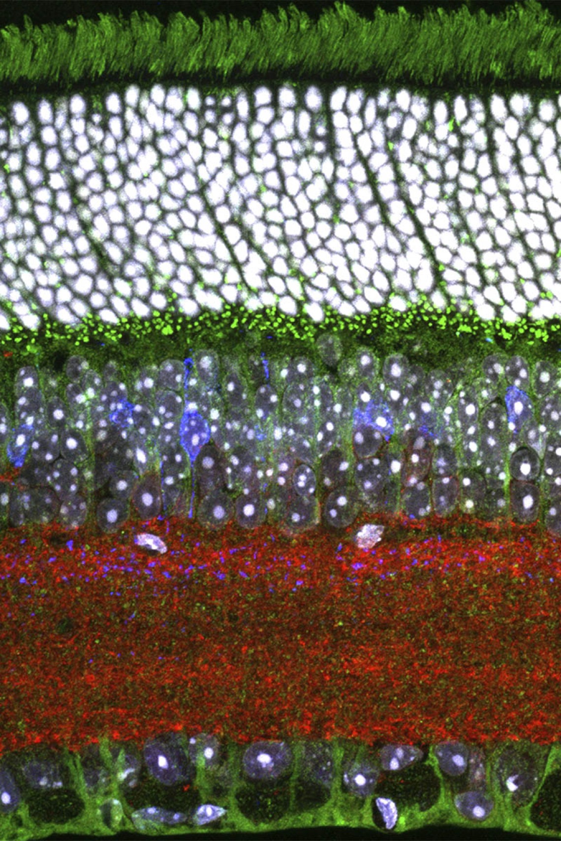 Image of the inner retina with some cone bipolar cells genetically labeled in cyan, cones and their processes also labeled in cyan, actin labeled in red and cell nuclei labeled in white.