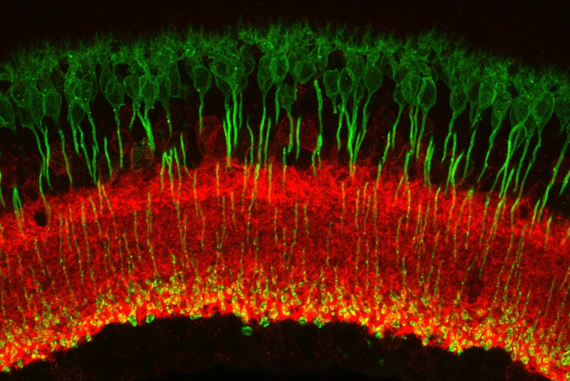 An image of a retina captured under a microscope by Andrea Wellington, assistant research scientist in the Eggers Lab in the Department of Physiology at the College of Medicine – Tucson, shows rod bipolar cells labeled in green and inhibitory amacrine cells (GABAergic) labeled in red.