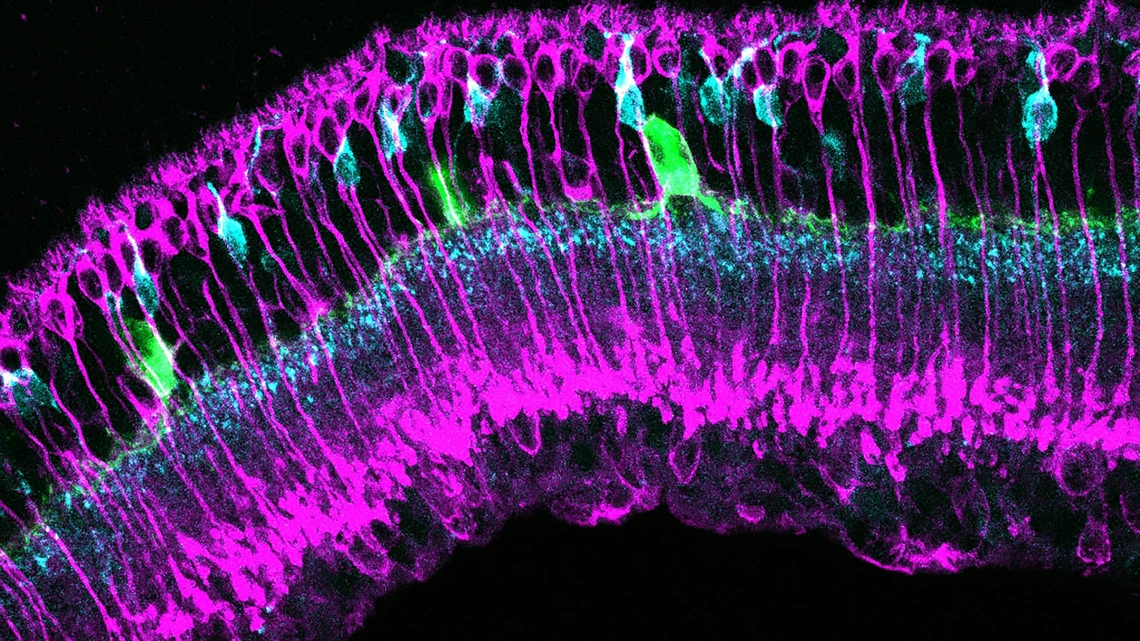 This image shows different types of retina cells labeled in green, magenta and cyan. Scientists are studying images like this from diabetic and control retinas to understand the cellular changes that occur in the early stages of diabetes, before vision loss occurs.