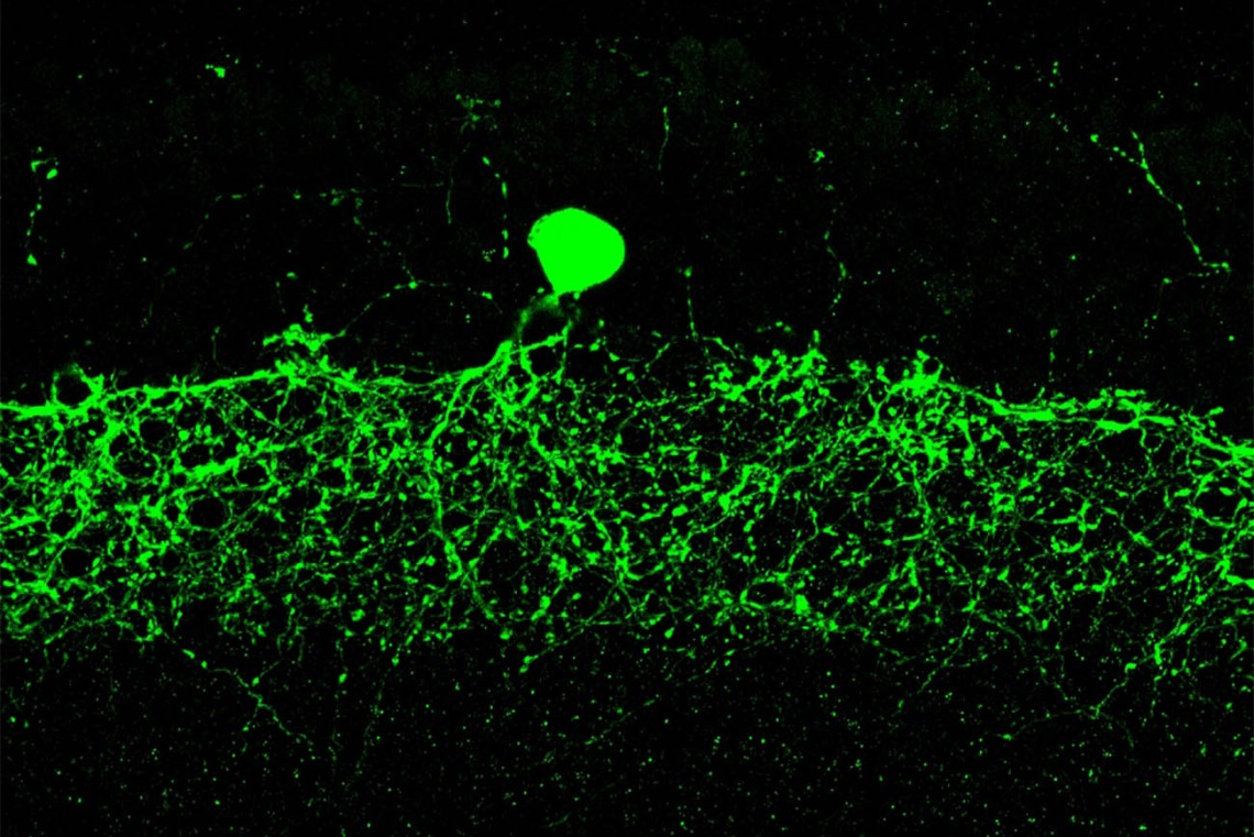 This image, captured under a confocal microscope, shows an immunostained dopaminergic amacrine cell in the inner retina.