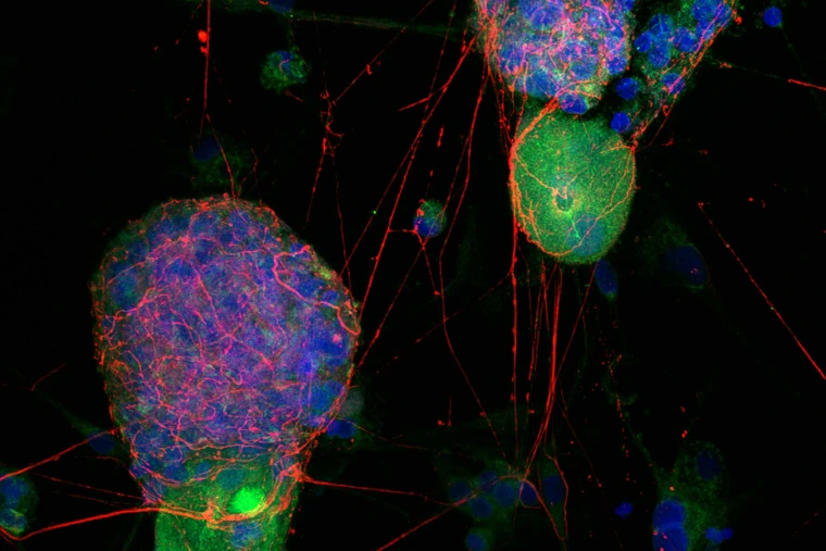 Colorful microscope image of male neurons and orexin receptors