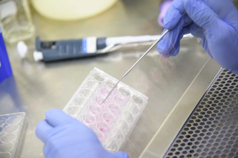  A close-up, high-angle shot of a person in a lab setting, wearing blue latex gloves. The person is using a long, thin metal tool to transfer a substance to a clear plastic plate with multiple wells, some of which contain a pink liquid. In the background, a pipette and other lab equipment are visible on a stainless steel surface.