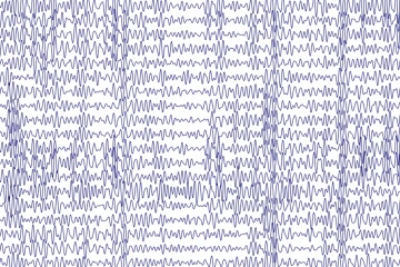 EEG image of multiple brain waves