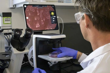 A person wearing a lab coat and gloves works at a microscope in a lab, viewing a monitor displaying a magnified image of cancer cells forming clusters on a petri dish