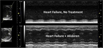 The treated image shows improved contractility of the heart, less ventricle/chamber dilation and improvement in wall thickness compared to the untreated heart.