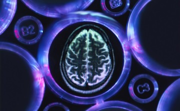 Alzheimers research image