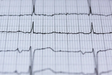 Electrocardiogram reading