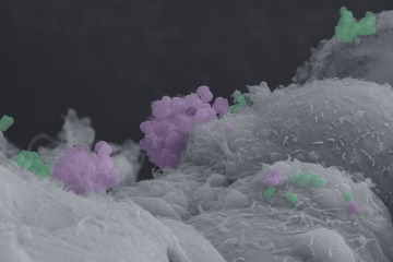 A microscopic image shows how N. gonorrhoeae (highlighted in pink) interacts with A. vaginae (highlighted in green), a bacteria associated with bacterial vaginosis.