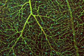This image shows the blood vessels in a retina in green, the cells that make up the blood-retina barrier in red, and dopamine-producing amacrine cells in cyan.
